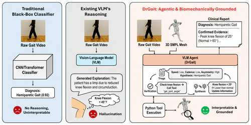 DrGait: Biomechanically Grounded Visual Reasoning for Interpretable Clinical Gait Analysis